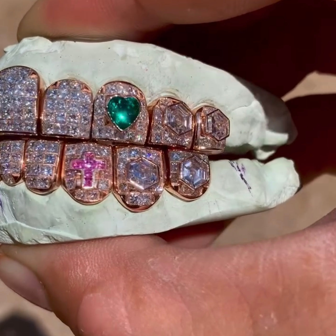 10 on 10 Baguette Moissanite Diamond Grillz 14K Rose Gold