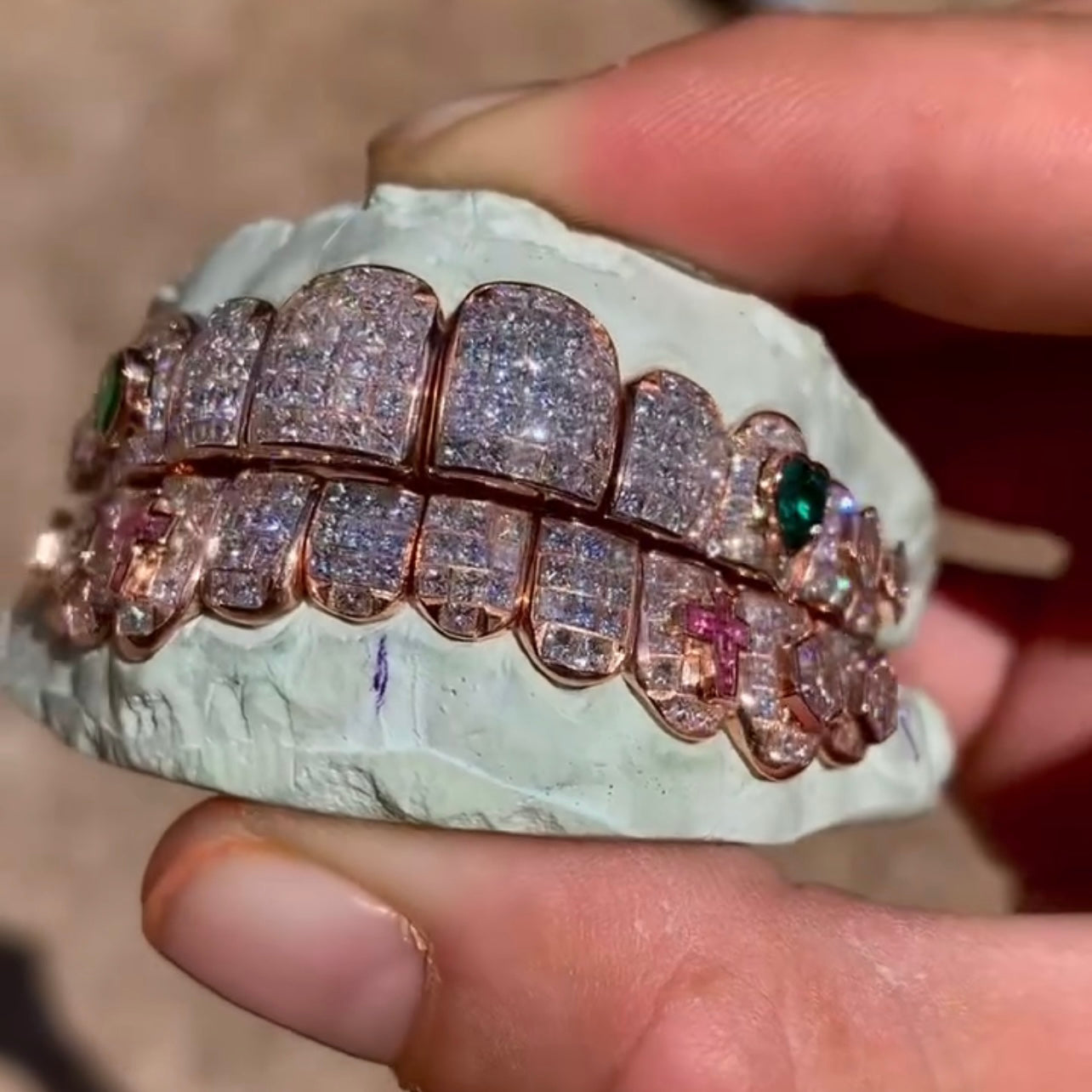 10 on 10 Baguette Moissanite Diamond Grillz 14K Rose Gold