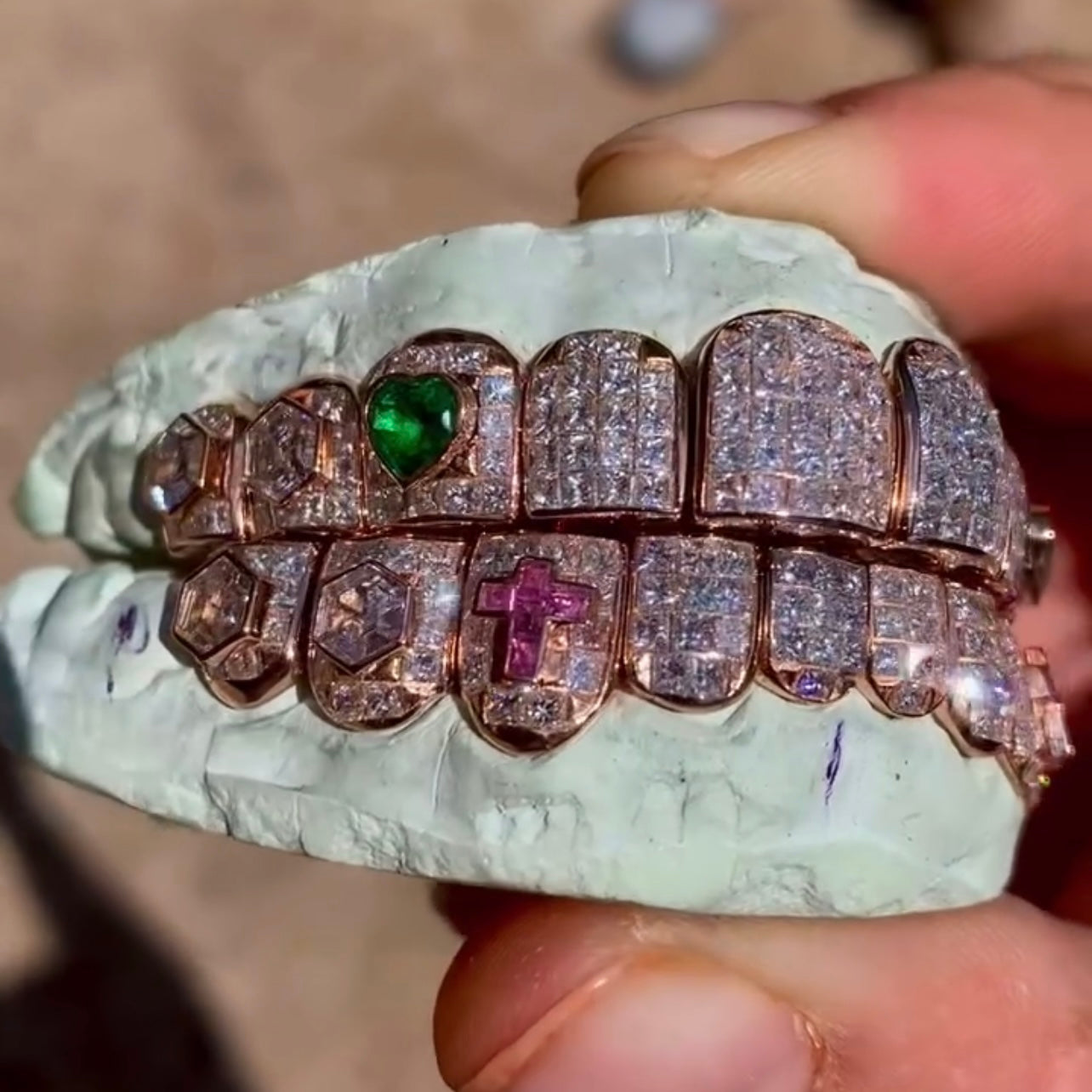 10 on 10 Baguette Moissanite Diamond Grillz 14K Rose Gold