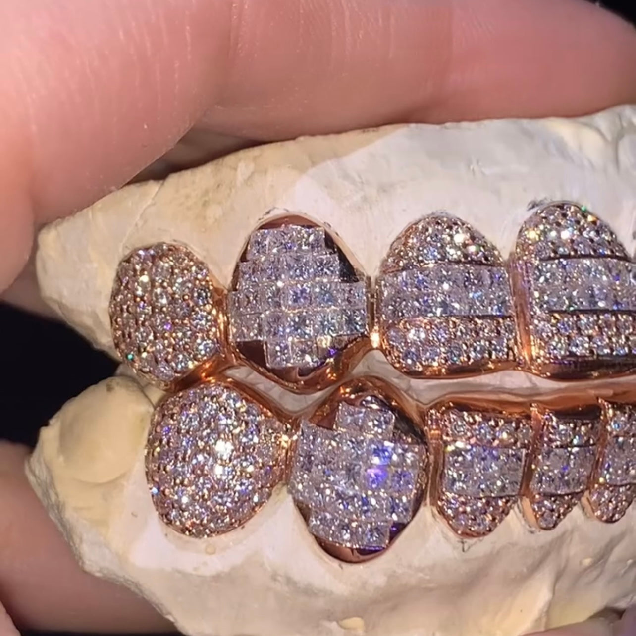 10 on 10 VVS Moissanite Diamond Grillz 14K Rose Gold