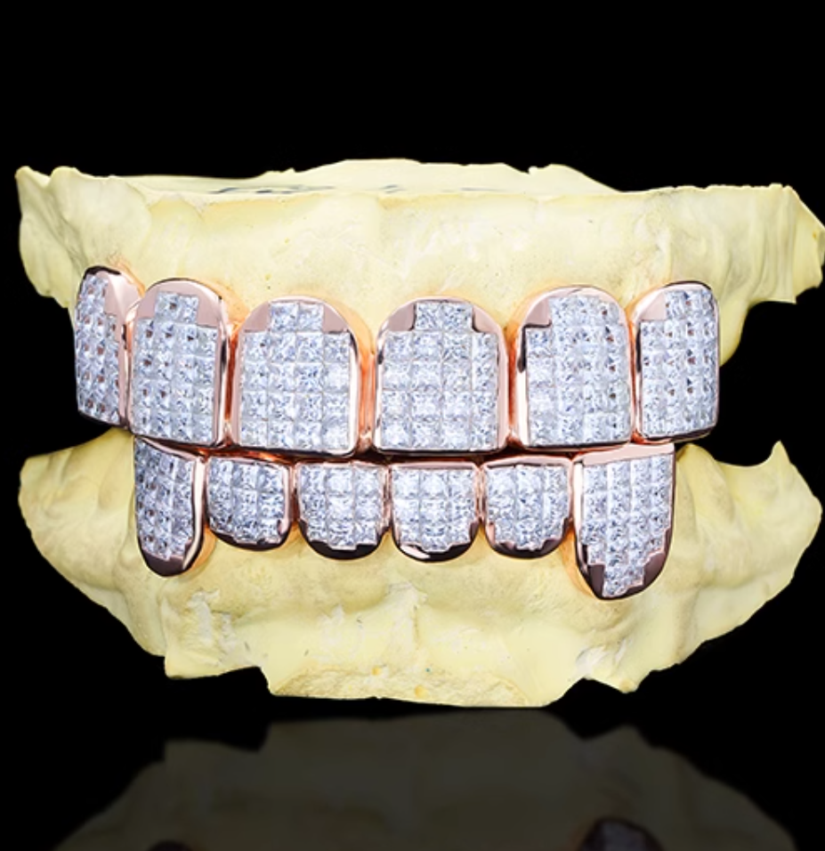 8 on 8 Baguette Moissanite Diamond Grillz 10K Rose Gold