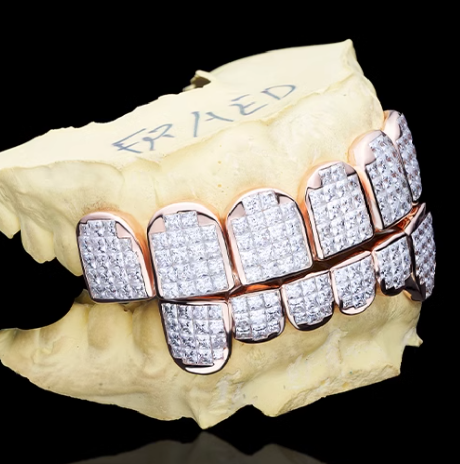 8 on 8 Baguette Moissanite Diamond Grillz 10K Rose Gold