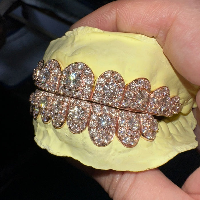 8 on 8 Custom Moissanite Diamond Grillz 10K Rose Gold