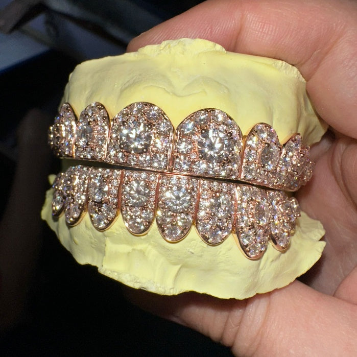 8 on 8 Custom Moissanite Diamond Grillz 10K Rose Gold
