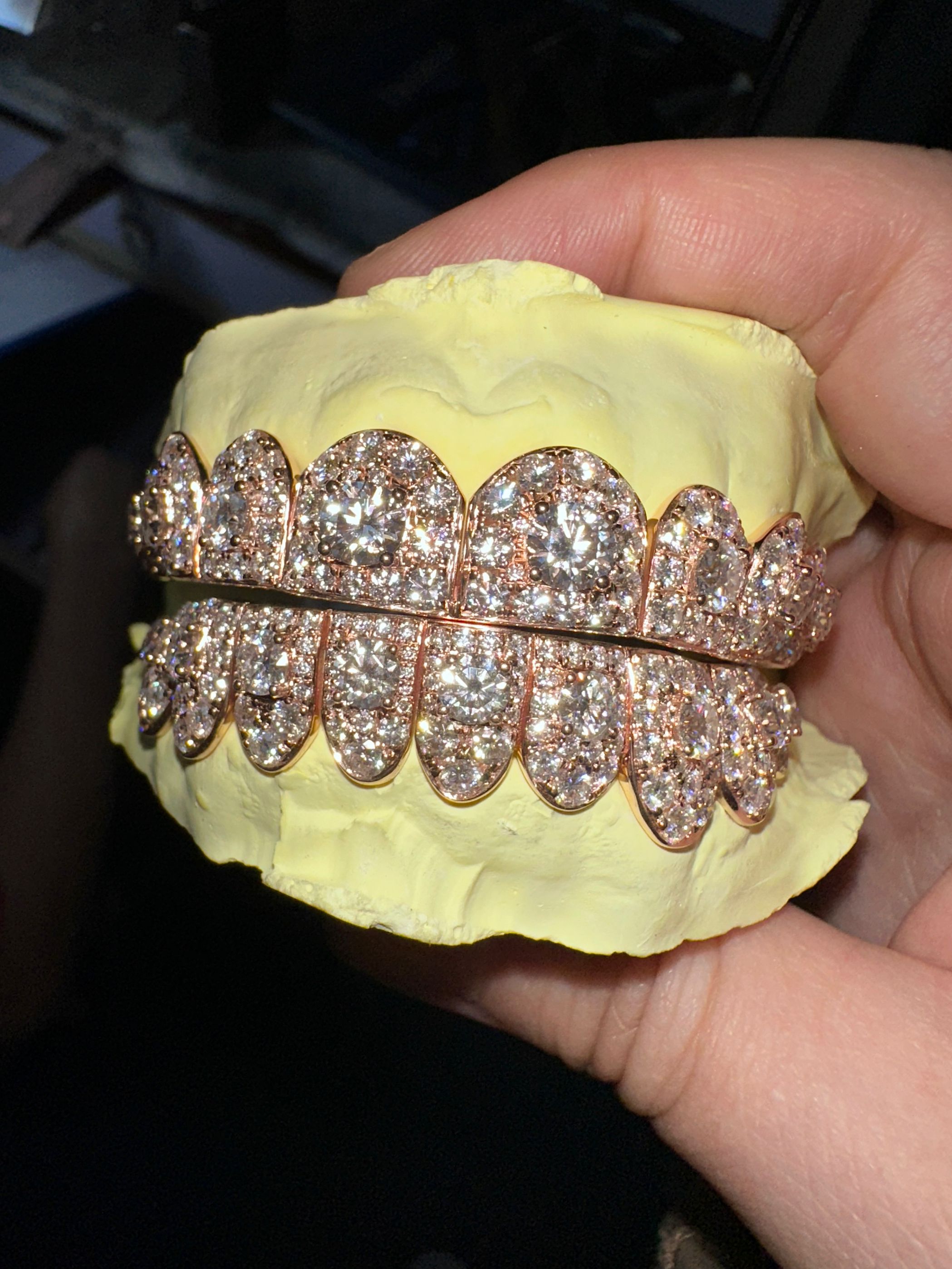8 on 8 Custom Moissanite Diamond Grillz 10K Rose Gold