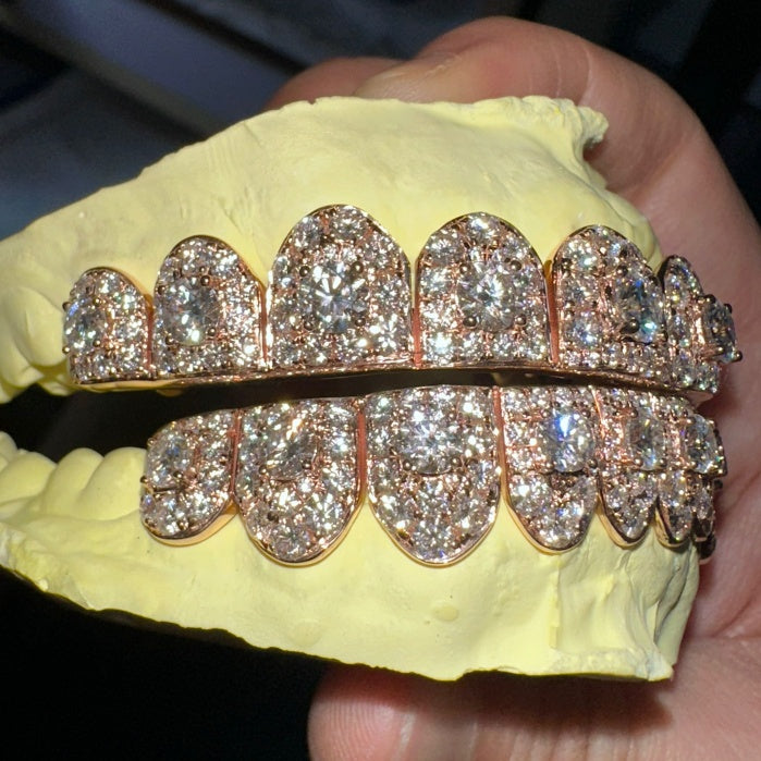 8 on 8 Custom Moissanite Diamond Grillz 10K Rose Gold