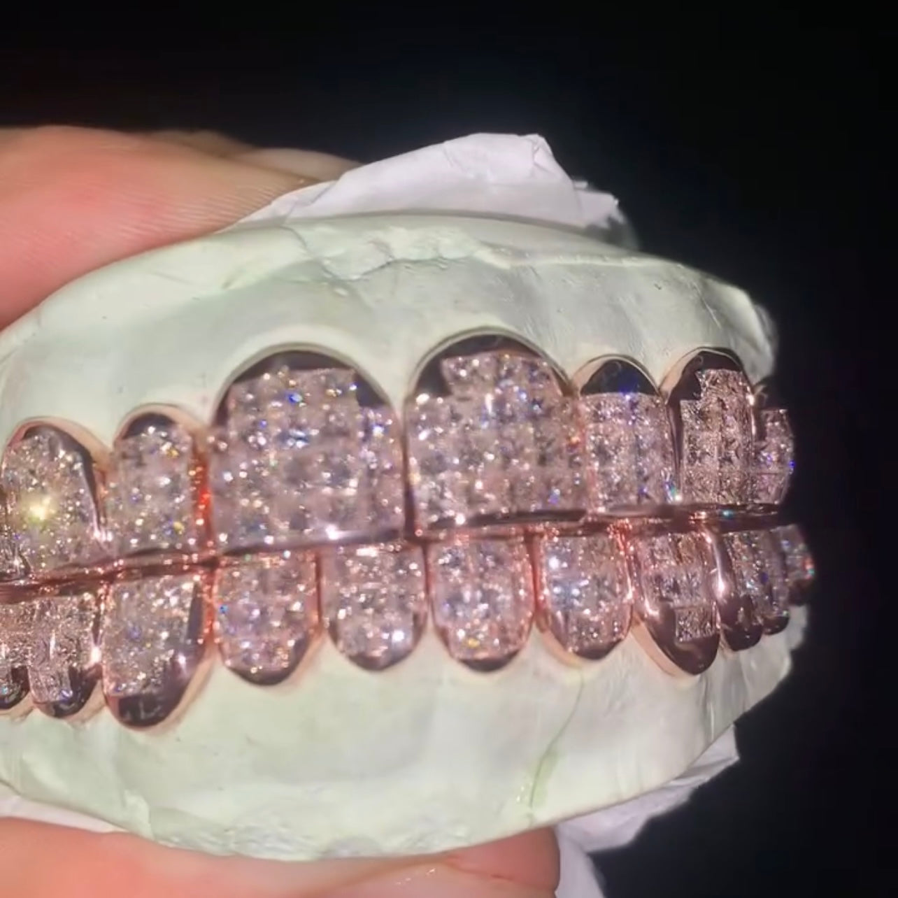 8 on 8 VVS Moissanite Diamond Grillz 14K Rose Gold