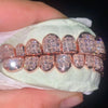 8 on 8 VVS Moissanite Diamond Grillz 14K Rose Gold