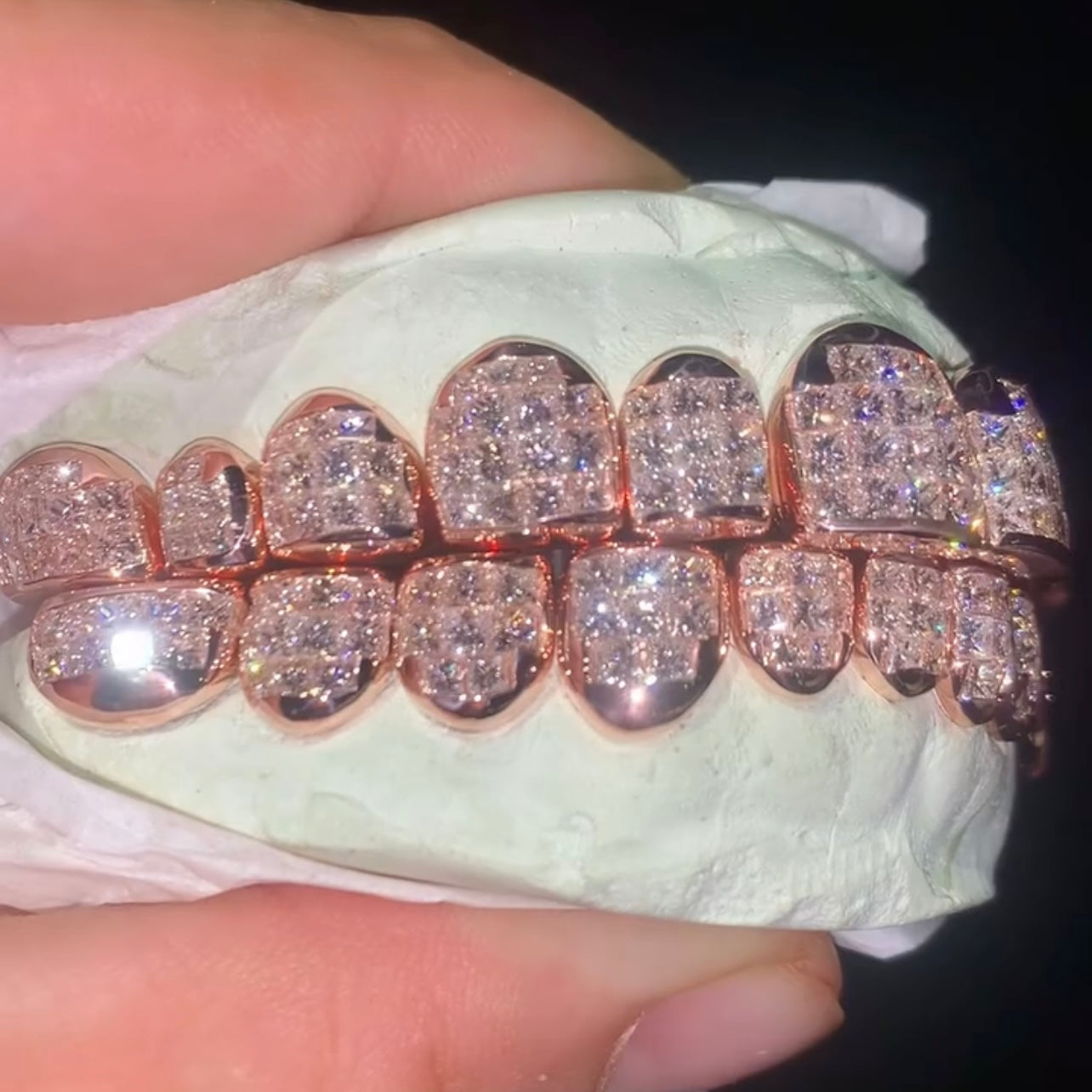 8 on 8 VVS Moissanite Diamond Grillz 14K Rose Gold