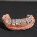 10 on 10 Custom Moissanite Diamond Grillz 10K Gold