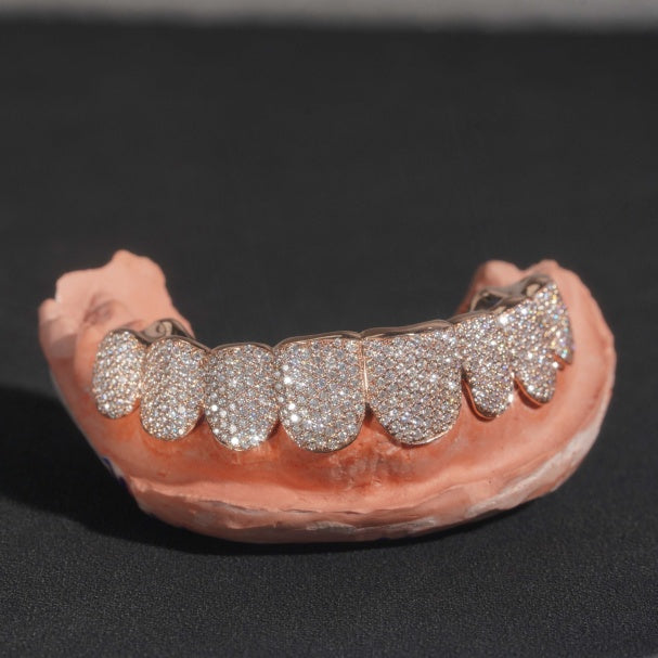 10 on 10 Custom Moissanite Diamond Grillz 10K Gold