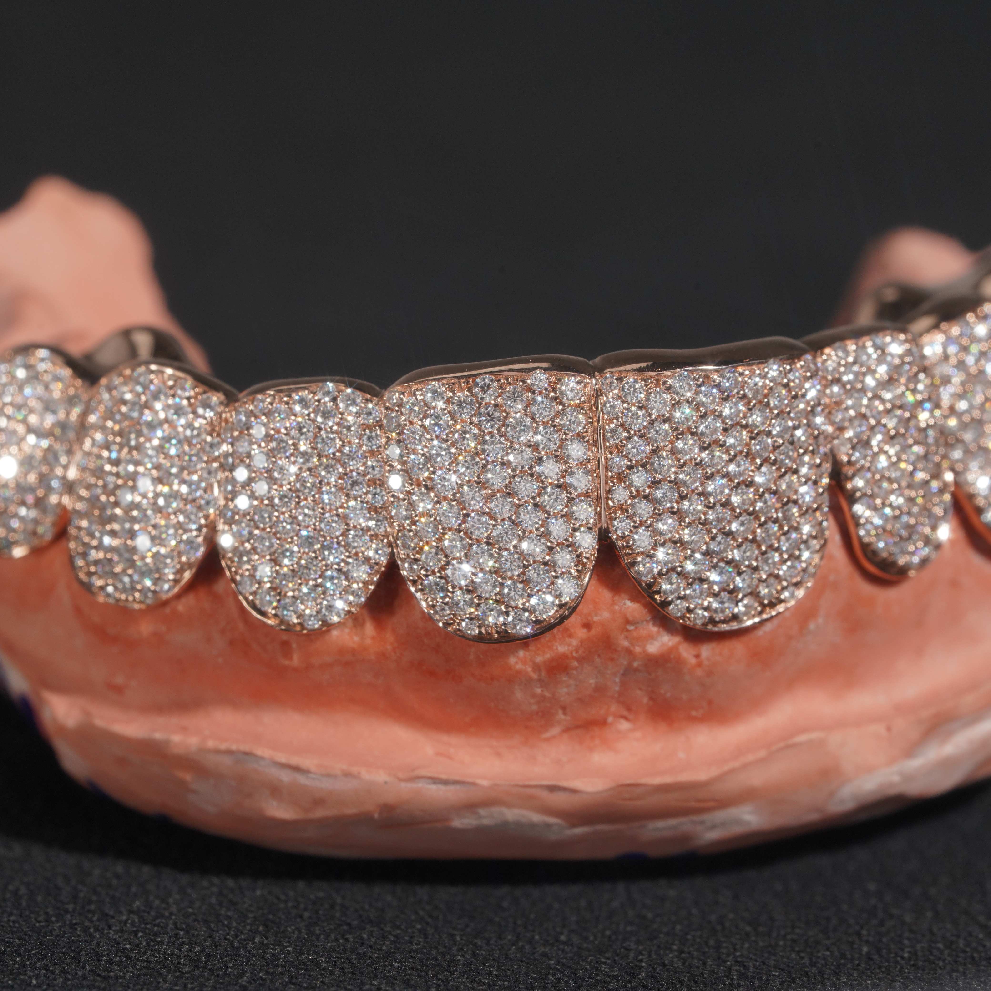10 on 10 Custom Moissanite Diamond Grillz 10K Gold