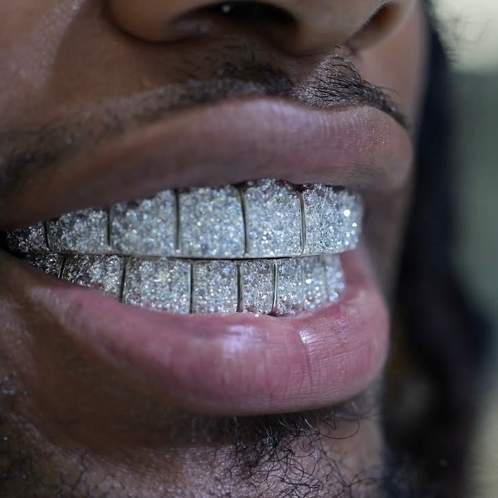 Man wearing a full set of iced-out moissanite grillz, top and bottom rows — CustomHipHop