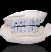 10 on 10 Custom Letter Moissanite Diamond Grillz 14K Gold