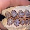 10 on 10 VVS Moissanite Diamond Grillz 14K Rose Gold