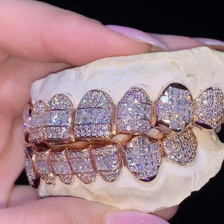 10 on 10 VVS Moissanite Diamond Grillz 14K Rose Gold