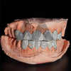 6 on 6 Custom Moissanite Diamond Grillz 10K Rose Gold