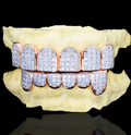 8 on 8 Baguette Moissanite Diamond Grillz 10K Rose Gold