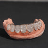 10 on 10 Custom Moissanite Diamond Grillz 10K Gold