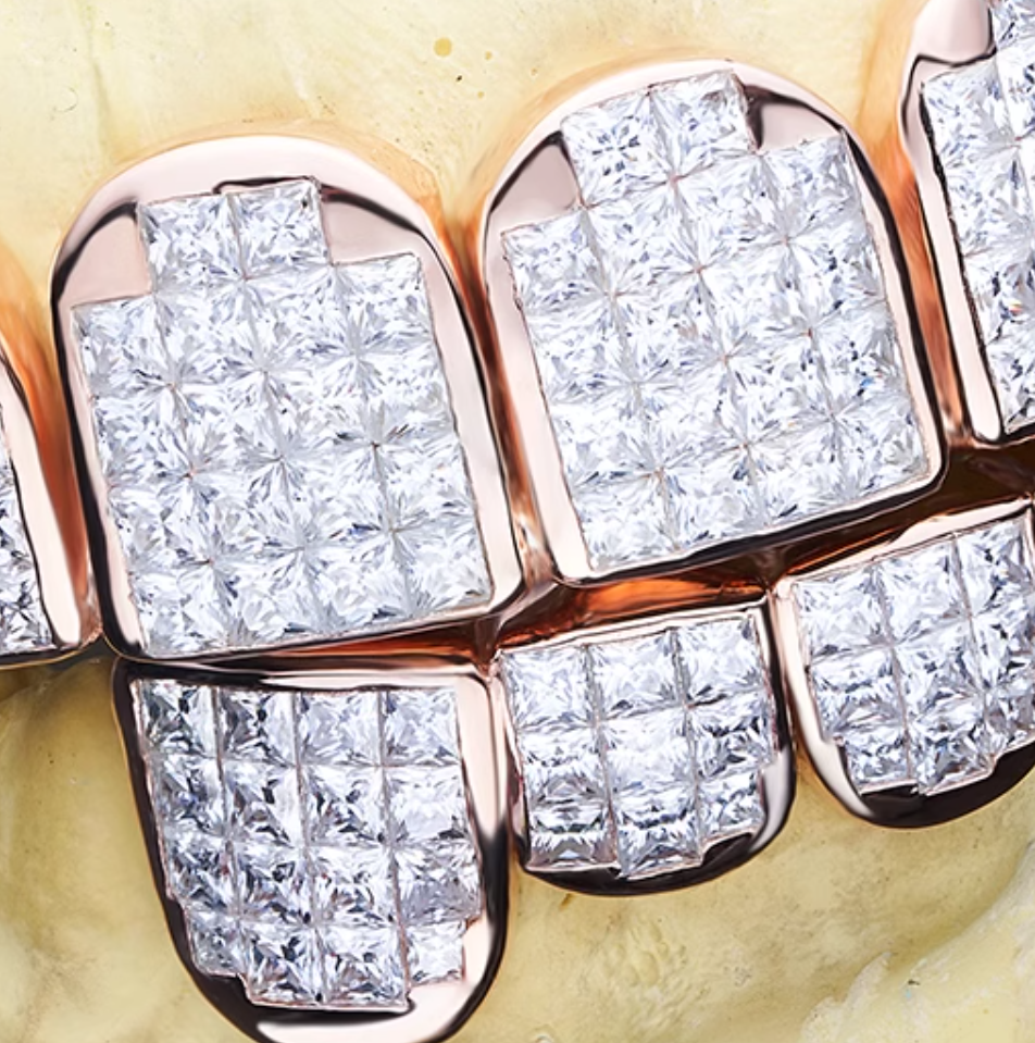 Rose Gold Plated Silver Moissanite Diamond Grillz, 6 Top 6 Bottom Set, Hip Hop Jewelry